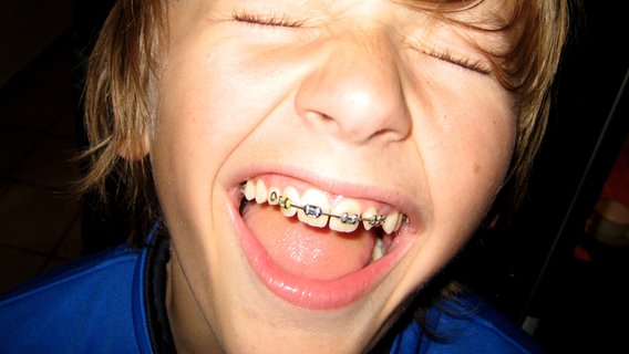 Ein Junge mit einer Zahnspange lacht. © Smubo / photocase.de Foto: Smubo / photocase.de