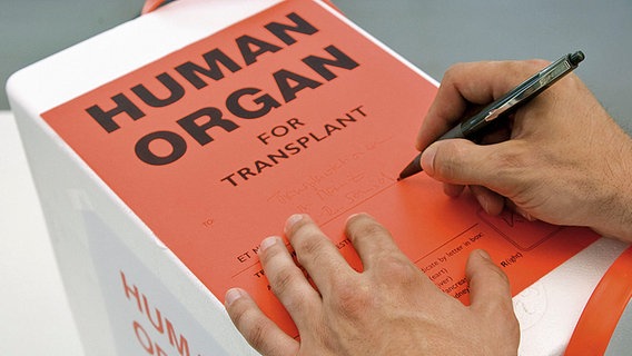 Eine Box mit einem menschlichen Organ. © DSO Foto: J. Rey
