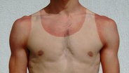 Zu sehen ist der Oberkörper eines Mannes mit einem Sonnenbrand und T-Shirt-Abdruck © cydonna / photocase.de Foto: cydonna